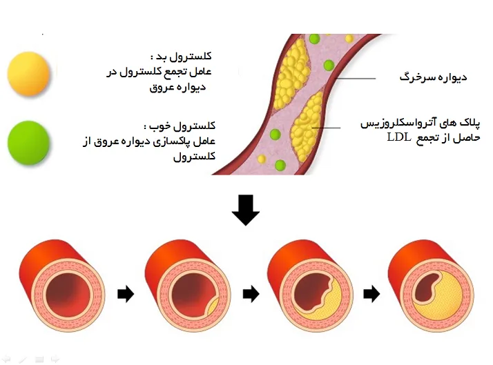 دویني غوړ یا (Cholesterol) 1 2H 7735